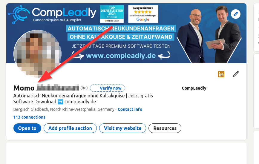 LinkedIn-Profil mit nicht eindeutig zuordenbarem Vornamen (Profilbild und Nachname verpixelt)